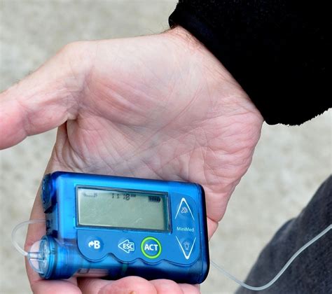 FDA approves first continuous glucose monitoring system with a 